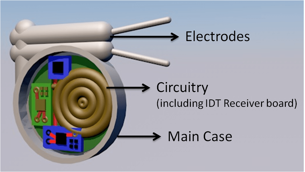 Pacemaker with Wireless Charging Capabilities Hackster.io